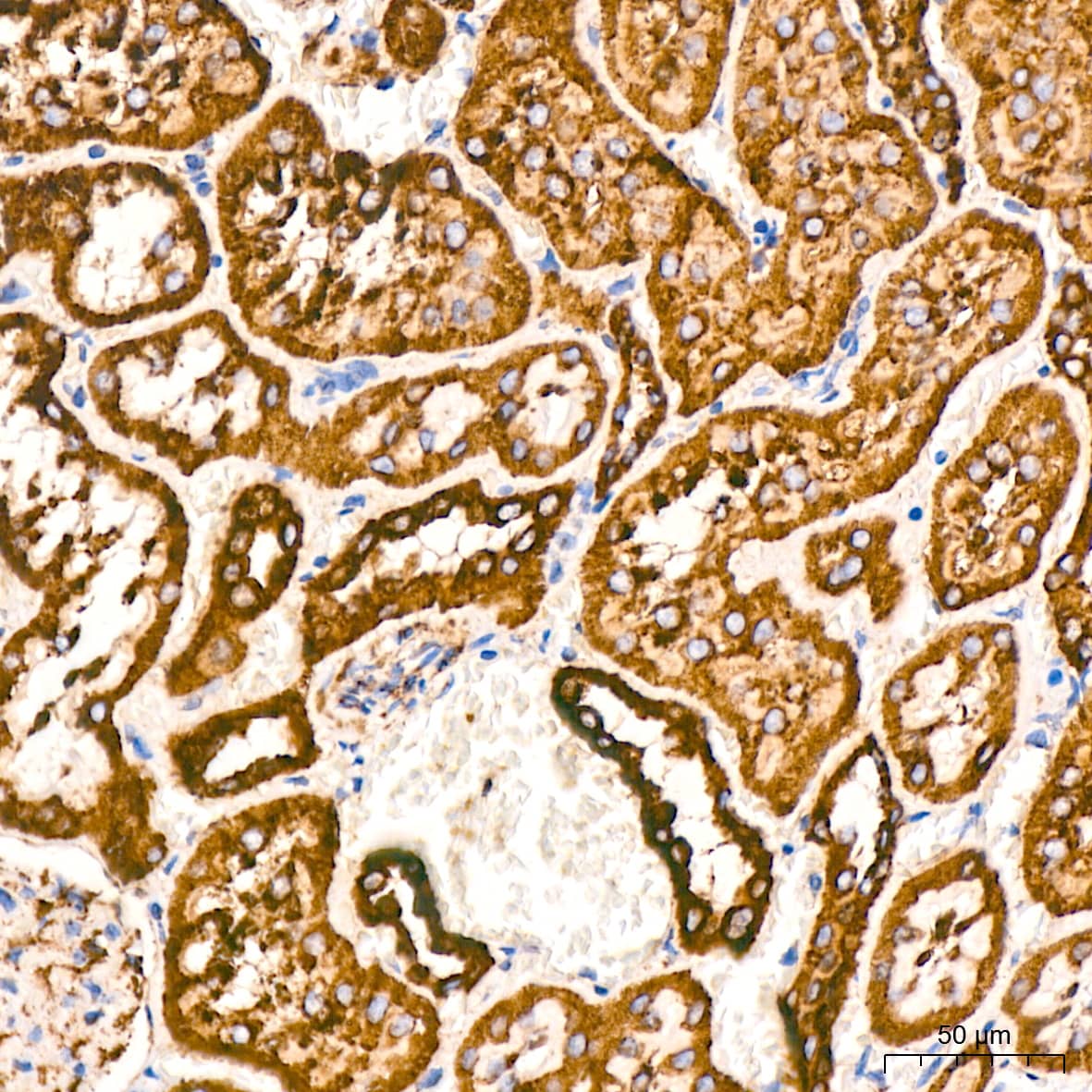 Immunohistochemistry: VDAC1 Antibody (6B1K1) [VDAC1] - Immunohistochemistry analysis of paraffin-embedded Rat kidney tissue using VDAC1 Rabbit mAb  at a dilution of 1:200 (40x lens). High pressure antigen retrieval performed with 0.01M Citrate Bufferr (pH 6.0) prior to IHC staining.