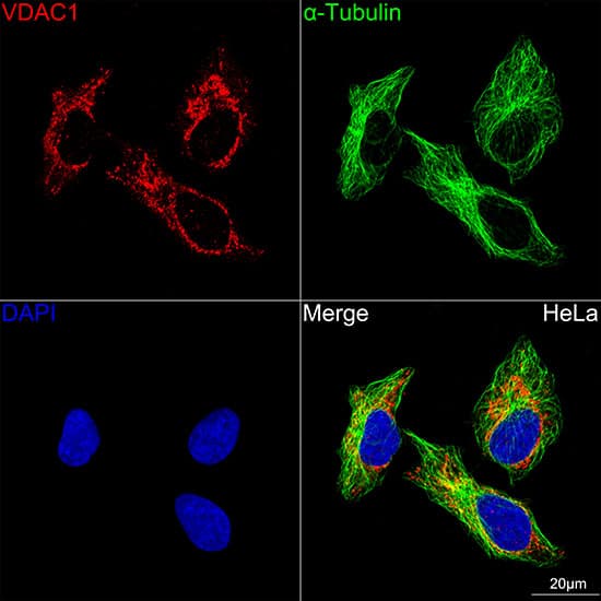 Immunocytochemistry/ Immunofluorescence: VDAC1 Antibody (6B1K1) [VDAC1] - Confocal imaging of HeLa cells using VDAC1 Rabbit mAb . The cells were counterstained with alpha-Tubulin Mouse mAb  (Green). DAPI was used for nuclear staining (blue). Objective: 100x.