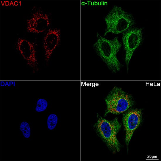 Immunocytochemistry/ Immunofluorescence: VDAC1 Antibody (6B1K1) [VDAC1] - Confocal imaging of HeLa cells using VDAC1 Rabbit mAb  followed by a further incubation with Cy3 Goat Anti-Rabbit IgG (H+L)  . The cells were counterstained with alpha-Tubulin Mouse mAb  followed by incubation with ABflo 488-conjugated Goat Anti-Mouse IgG (H+L) Ab  (Green). DAPI was used for nuclear staining (Blue). Objective: 100x.