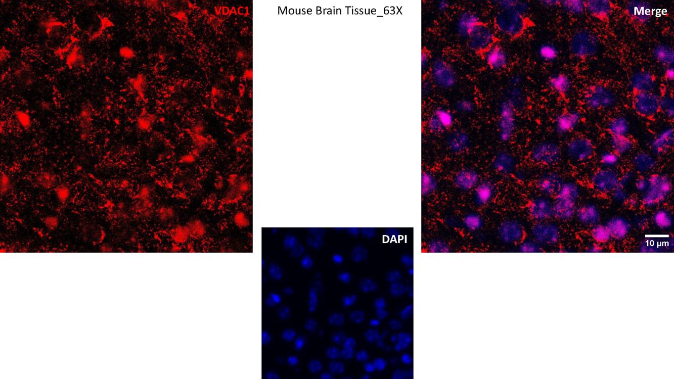 Mouse was perfused with PFA, and brain sections were prepared using a cryosectioning method. The primary antibody for IF was used at a dilution ratio of 1:50. Image from a verified customer review.