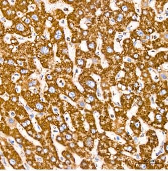 Immunohistochemistry-Paraffin: VDAC1 Antibody (6B1K1) [NBP3-15871] -Human liver tissue using VDAC1 Rabbit mAb at a dilution of 1:200 (40x lens). High pressure antigen retrieval was performed with 0.01 M citrate buffer (pH 6.0) prior to IHC staining.