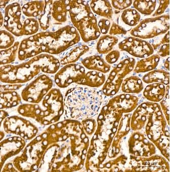 Immunohistochemistry-Paraffin: VDAC1 Antibody (6B1K1) [NBP3-15871] -Mouse kidney tissue using VDAC1 Rabbit mAb at a dilution of 1:200 (40x lens). High pressure antigen retrieval was performed with 0.01 M citrate buffer (pH 6.0) prior to IHC staining.