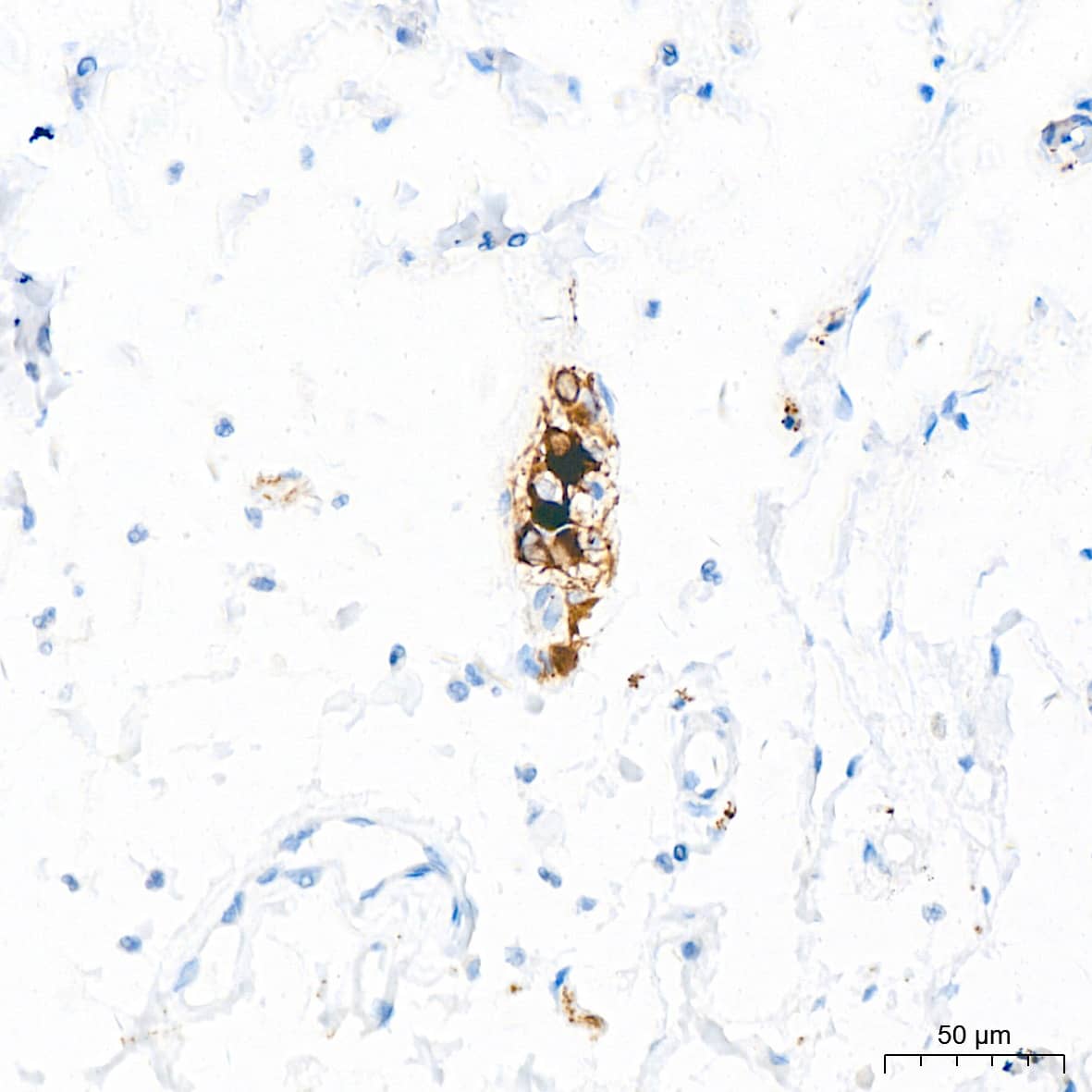 Immunohistochemistry: NF-L Antibody (3L9Y10) - Azide and BSA Free [NF-L] - Immunohistochemistry analysis of paraffin-embedded Human colon tissue using NF-L Rabbit mAb  at a dilution of 1:500 (40x lens). High pressure antigen retrieval performed with 0.01M Citrate Buffer (pH 6.0) prior to IHC staining.