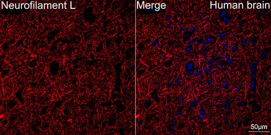 Immunocytochemistry/ Immunofluorescence: NF-L Antibody (3L9Y10) - Azide and BSA Free [NF-L] - Confocal imaging of Human brain tissue using NF-L Rabbit mAb  . DAPI was used for nuclear staining (blue). Objective: 40x.Perform high pressure antigen retrieval with 10 mM citrate buffer pH 6.0 before commencing with IF staining protocol.