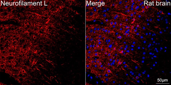 Immunocytochemistry/ Immunofluorescence: NF-L Antibody (3L9Y10) - Azide and BSA Free [NF-L] - Confocal imaging of paraffin-embedded Rat brain tissue using NF-L Rabbit mAb  followed by a further incubation with Cy3 Goat Anti-Rabbit IgG (H+L)  . DAPI was used for nuclear staining (Blue). Objective: 40x. Perform microwave antigen retrieval with 0.01 M citrate buffer (pH 6.0) prior to IF staining.