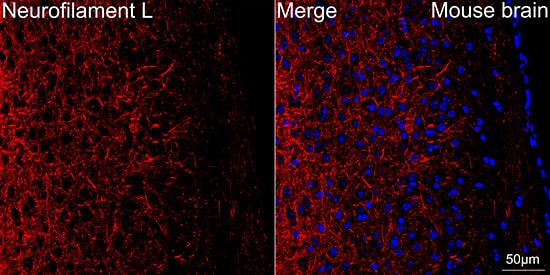 Immunocytochemistry/ Immunofluorescence: NF-L Antibody (3L9Y10) - Azide and BSA Free [NF-L] - Confocal imaging of paraffin-embedded Mouse brain tissue using NF-L Rabbit mAb  followed by a further incubation with Cy3 Goat Anti-Rabbit IgG (H+L)  . DAPI was used for nuclear staining (Blue). Objective: 40x. Perform microwave antigen retrieval with 0.01 M citrate buffer (pH 6.0) prior to IF staining.