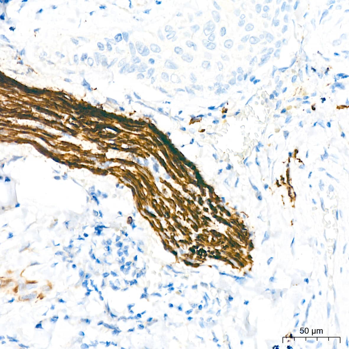 Immunohistochemistry: NF-L Antibody (3L9Y10) - Azide and BSA Free [NF-L] - Immunohistochemistry analysis of paraffin-embedded Human thyroid tissue using NF-L Rabbit mAb  at a dilution of 1:500 (40x lens). High pressure antigen retrieval performed with 0.01M Citrate Buffer (pH 6.0) prior to IHC staining.