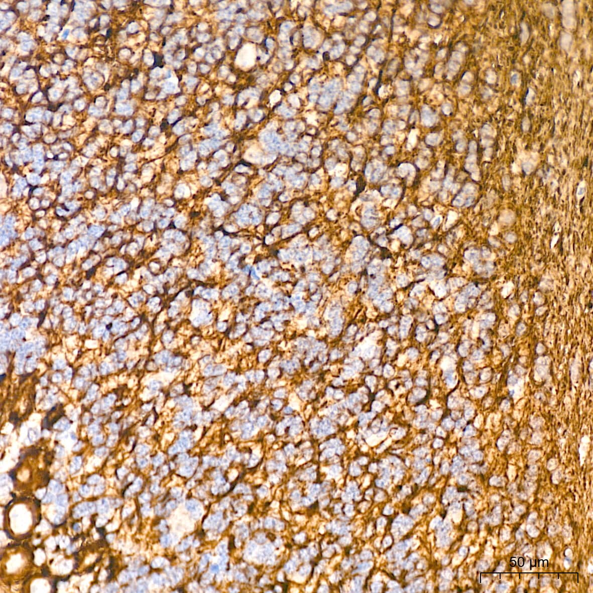 Immunohistochemistry: NF-L Antibody (3L9Y10) - Azide and BSA Free [NF-L] - Immunohistochemistry analysis of paraffin-embedded Rat brain tissue using NF-L Rabbit mAb  at a dilution of 1:500 (40x lens). High pressure antigen retrieval performed with 0.01M Citrate Buffer (pH 6.0) prior to IHC staining.