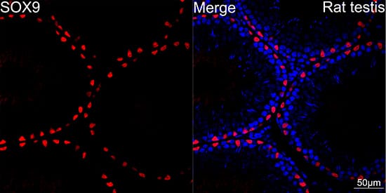 Immunocytochemistry/ Immunofluorescence: SOX9 Antibody (5Y4J8) [SOX9] - Confocal imaging of paraffin-embedded Rat testis using SOX9 Rabbit mAb  followed by a further incubation with Cy3 Goat Anti-Rabbit IgG (H+L)  . DAPI was used for nuclear staining (Blue). Objective: 40x.Perform high pressure antigen retrieval with 0.01M citrate buffer (pH 6.0) prior to IF staining.