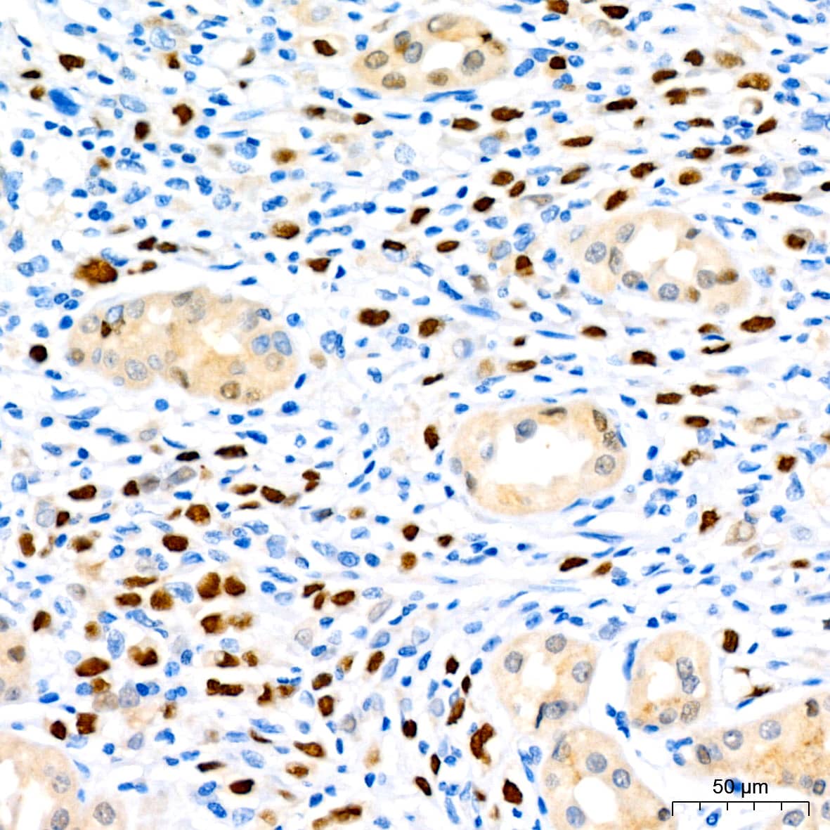 Immunohistochemistry: SOX9 Antibody (5Y4J8) [SOX9] - Immunohistochemistry analysis of paraffin-embedded Human stomach using SOX9 Rabbit mAb  at dilution of 1:400 (40x lens). High pressure antigen retrieval performed with 0.01M Tris/EDTA Buffer (pH 9.0) prior to IHC staining.