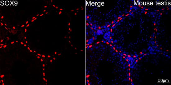 Immunocytochemistry/ Immunofluorescence: SOX9 Antibody (5Y4J8) [SOX9] - Confocal imaging of paraffin-embedded Mouse testis using SOX9 Rabbit mAb  followed by a further incubation with Cy3 Goat Anti-Rabbit IgG (H+L)  . DAPI was used for nuclear staining (Blue). Objective: 40x.Perform high pressure antigen retrieval with 0.01M citrate buffer (pH 6.0) prior to IF staining.