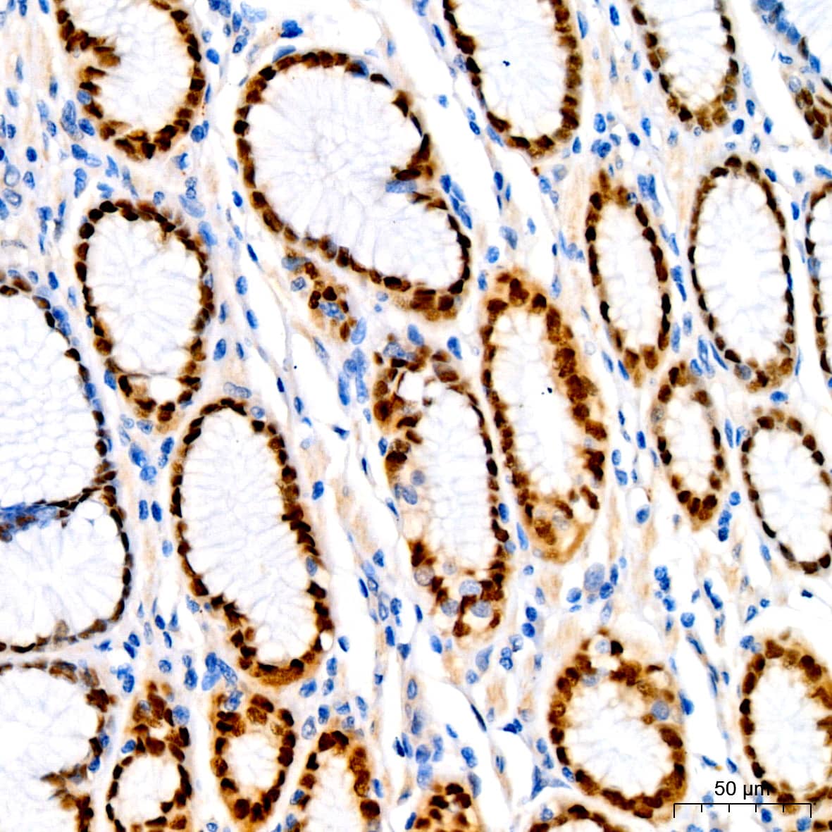 Immunohistochemistry: SOX9 Antibody (5Y4J8) [SOX9] - Immunohistochemistry analysis of paraffin-embedded Human colon using SOX9 Rabbit mAb  at dilution of 1:400 (40x lens). High pressure antigen retrieval performed with 0.01M Tris/EDTA Buffer (pH 9.0) prior to IHC staining.