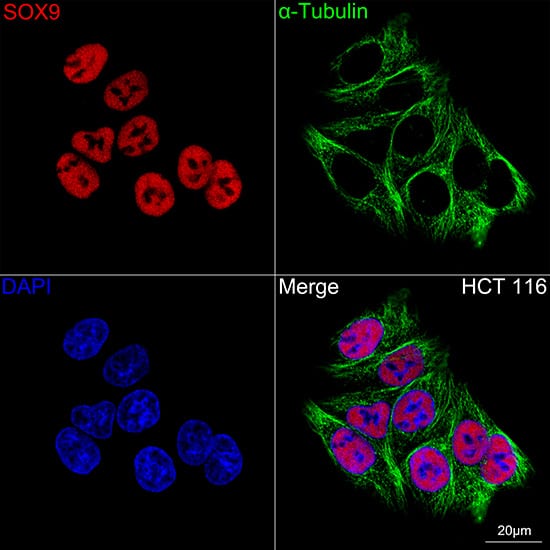 Immunocytochemistry/ Immunofluorescence: SOX9 Antibody (5Y4J8) [SOX9] - Confocal imaging of HCT 116 cells using SOX9 Rabbit mAb  followed by a further incubation with Cy3 Goat Anti-Rabbit IgG (H+L)  . The cells were counterstained with alpha-Tubulin Mouse mAb  followed by incubation with ABflo 488-conjugated Goat Anti-Mouse IgG (H+L) Ab  (Green). DAPI was used for nuclear staining (Blue). Objective: 100x.