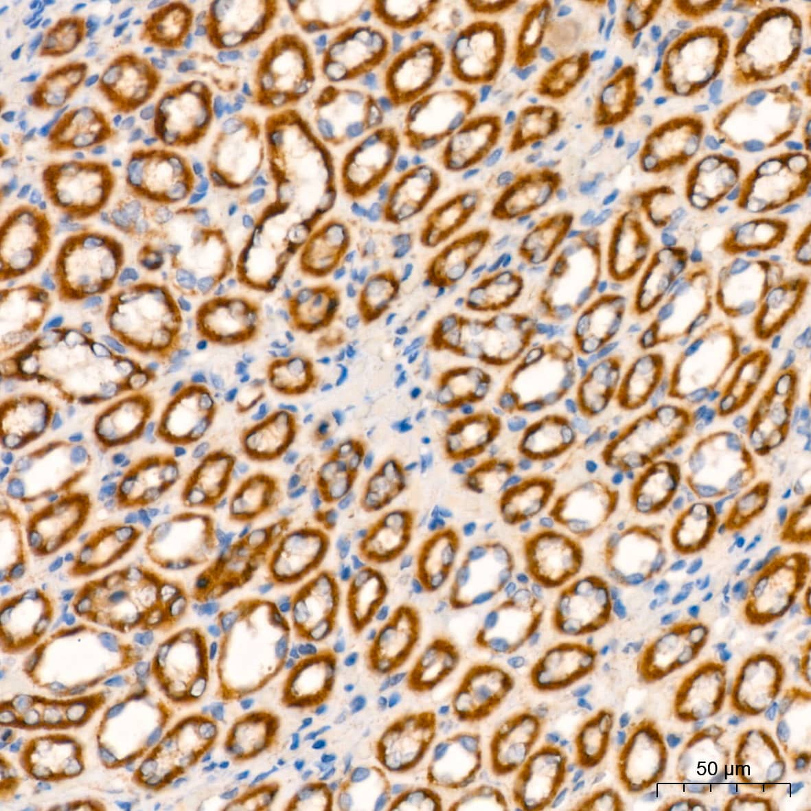 Immunohistochemistry: NDUFB8 Antibody (6T8G1) [NDUFB8] - Immunohistochemistry analysis of paraffin-embedded Rat kidney using NDUFB8 Rabbit mAb  at dilution of 1:200 (40x lens). High pressure antigen retrieval performed with 0.01M Citrate Bufferr (pH 6.0) prior to IHC staining.