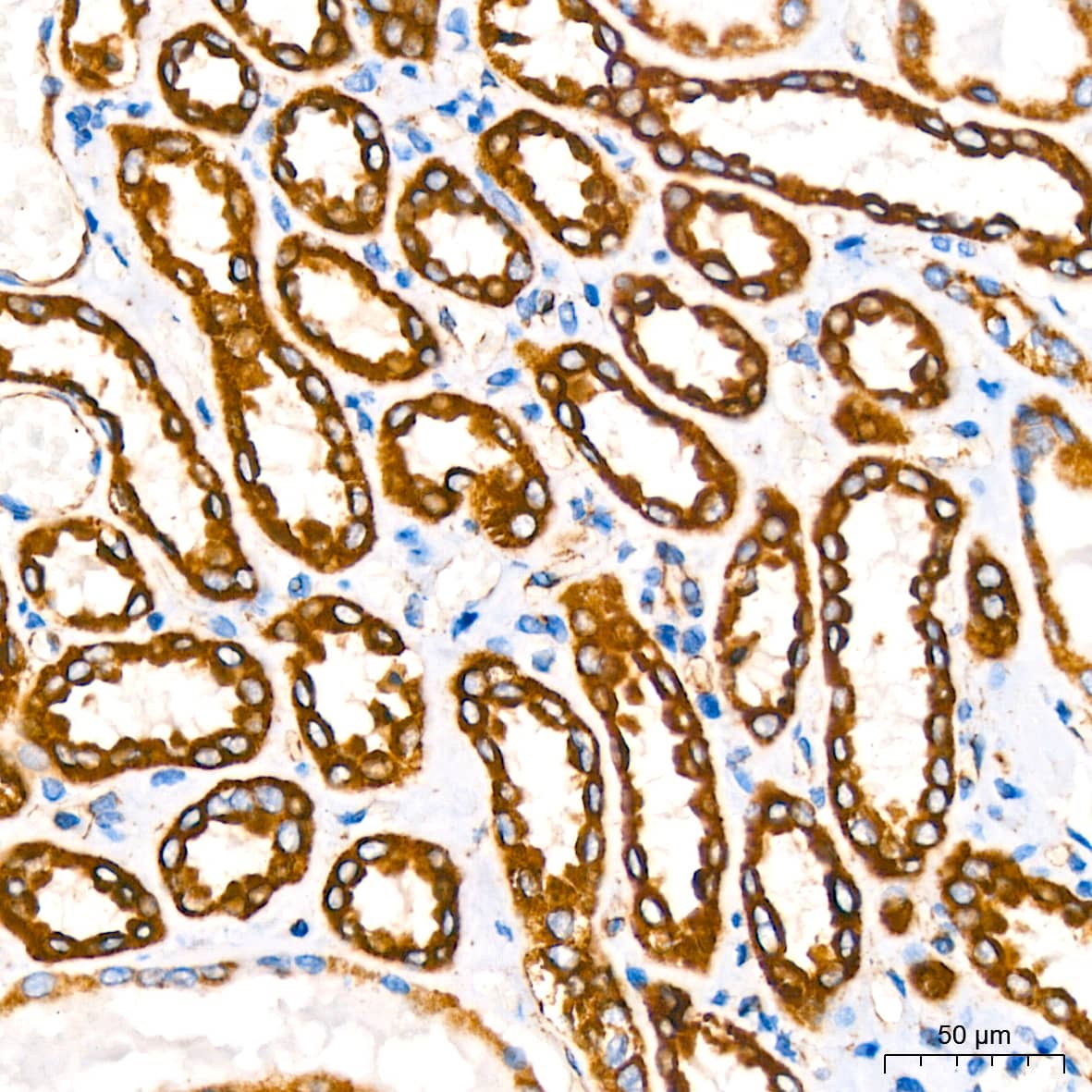 Immunohistochemistry: NDUFB8 Antibody (6T8G1) [NDUFB8] - Immunohistochemistry analysis of paraffin-embedded Human kidney using NDUFB8 Rabbit mAb  at dilution of 1:200 (40x lens). High pressure antigen retrieval performed with 0.01M Citrate Bufferr (pH 6.0) prior to IHC staining.