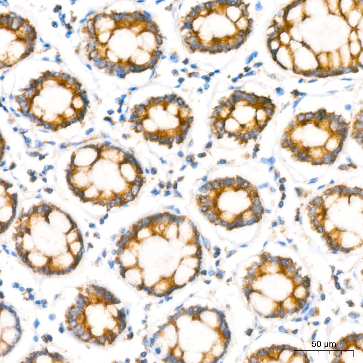 Immunohistochemistry: NDUFB8 Antibody (6T8G1) [NDUFB8] - Immunohistochemistry analysis of paraffin-embedded Human colon using NDUFB8 Rabbit mAb  at dilution of 1:200 (40x lens). High pressure antigen retrieval performed with 0.01M Citrate Bufferr (pH 6.0) prior to IHC staining.