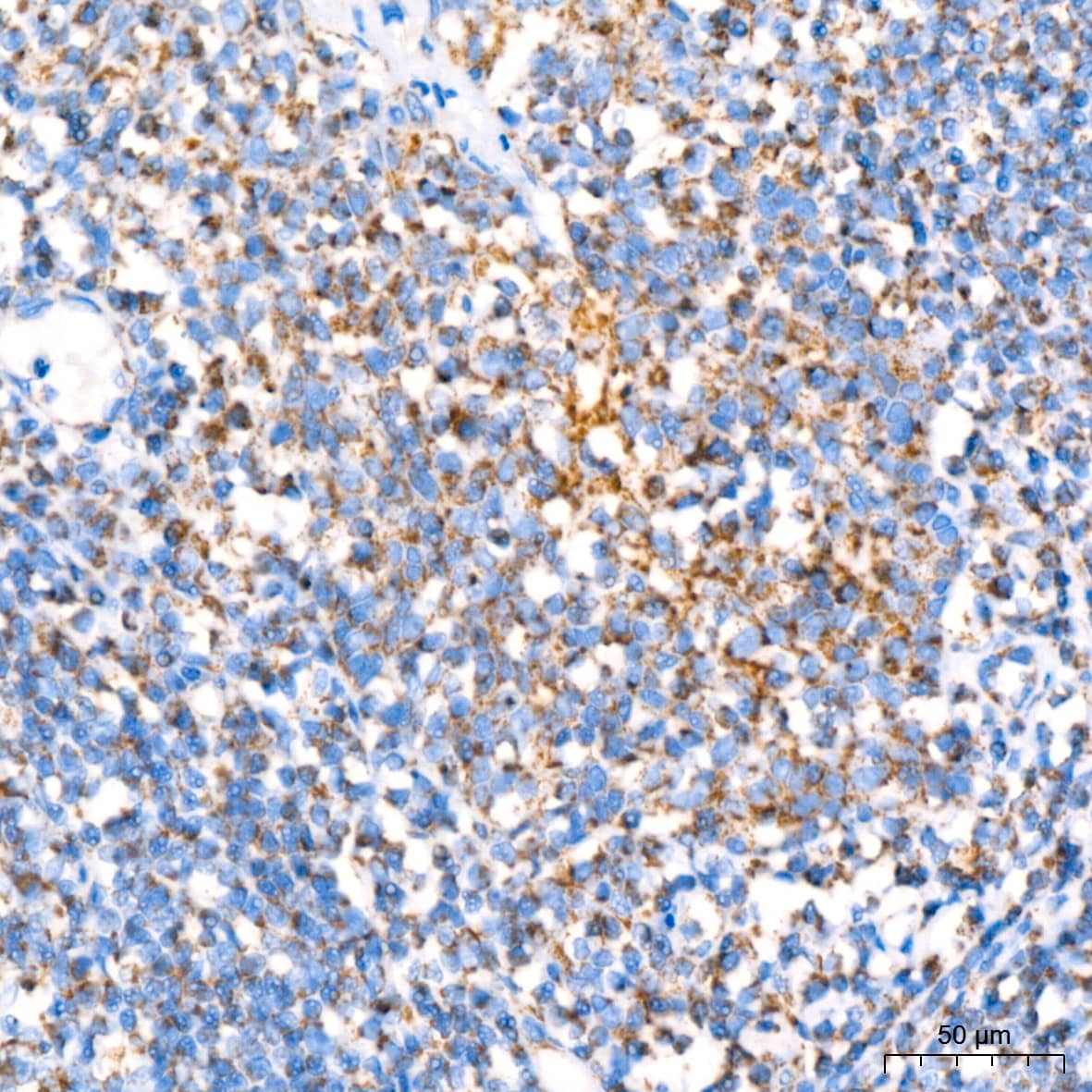 Immunohistochemistry: NDUFB8 Antibody (6T8G1) [NDUFB8] - Immunohistochemistry analysis of paraffin-embedded Human tonsil using NDUFB8 Rabbit mAb  at dilution of 1:200 (40x lens). High pressure antigen retrieval performed with 0.01M Citrate Bufferr (pH 6.0) prior to IHC staining.