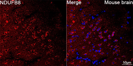 Immunocytochemistry/ Immunofluorescence: NDUFB8 Antibody (6T8G1) [NDUFB8] - Confocal imaging of paraffin-embedded Mouse brain using NDUFB8 Rabbit mAb  followed by a further incubation with Cy3 Goat Anti-Rabbit IgG (H+L)  . DAPI was used for nuclear staining (Blue). Objective: 40x. Perform microwave antigen retrieval with 0.01 M citrate buffer (pH 6.0) prior to IF staining.