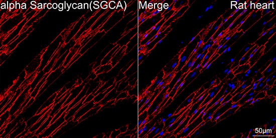 Immunocytochemistry/ Immunofluorescence: alpha-Sarcoglycan Antibody (3W3Q10) [alpha-Sarcoglycan] - Confocal imaging of paraffin-embedded Rat heart  using alpha-Sarcoglycan Rabbit mAb   followed by a further incubation with Cy3 Goat Anti-Rabbit IgG (H+L)  . DAPI was used for nuclear staining (Blue). Objective: 40x. Perform high pressure antigen retrieval with 0.01 M citrate buffer (pH 6.0) prior to IF staining.