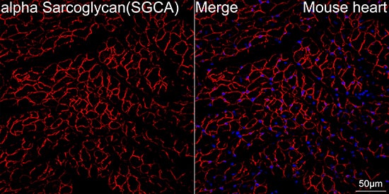 Immunocytochemistry/ Immunofluorescence: alpha-Sarcoglycan Antibody (3W3Q10) [alpha-Sarcoglycan] - Confocal imaging of paraffin-embedded Mouse heart using alpha-Sarcoglycan Rabbit mAb   followed by a further incubation with Cy3 Goat Anti-Rabbit IgG (H+L)  . DAPI was used for nuclear staining (Blue). Objective: 40x. Perform high pressure antigen retrieval with 0.01 M citrate buffer (pH 6.0) prior to IF staining.