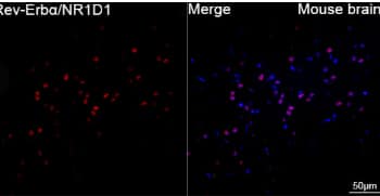Immunohistochemistry-Paraffin Rev-erb A alpha/NR1D1 Antibody (9I2H1)