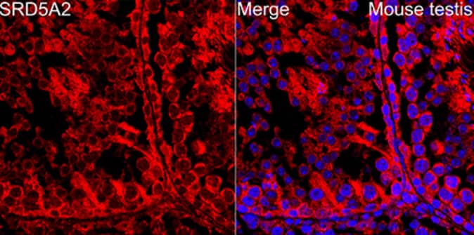 Immunohistochemistry-Paraffin: SRD5A2 Antibody (8A4H5) [NBP3-15900] - Analysis of paraffin-embedded mouse testis using SRD5A2 Rabbit mAb at dilution of 1:100 (40x lens). Secondary antibody: Cy3-conjugated Goat anti-Rabbit IgG (H+L) at 1:500 dilution. Blue: DAPI for nuclear staining.