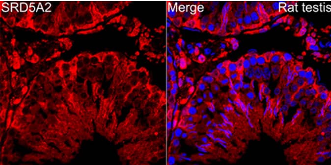 Immunohistochemistry-Paraffin: SRD5A2 Antibody (8A4H5) [NBP3-15900] - Analysis of paraffin-embedded rat testis using SRD5A2 Rabbit mAb at dilution of 1:100 (40x lens). Secondary antibody: Cy3-conjugated Goat anti-Rabbit IgG (H+L) at 1:500 dilution. Blue: DAPI for nuclear staining.