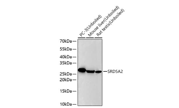 Analysis of various lysates using SRD5A2 Rabbit mAb at 1:7000 dilution incubated overnight at 4℃.Secondary antibody: HRP-conjugated Goat anti-Rabbit IgG (H+L) at 1:10000 dilution.Lysates/proteins: 25 μg per lane.Blocking buffer: 3% nonfat dry milk in TBST.Detection: ECL Basic Kit. Exposure time: 45 s.