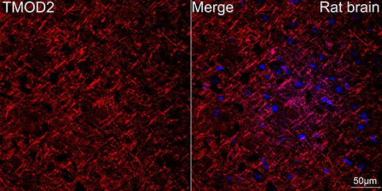 Immunocytochemistry/ Immunofluorescence: Tropomodulin 2 Antibody (5E7G5) [Tropomodulin 2] - Confocal imaging of paraffin-embedded Rat brain tissue using Tropomodulin 2 Rabbit mAb  followed by a further incubation with Cy3 Goat Anti-Rabbit IgG (H+L)  . DAPI was used for nuclear staining (Blue). Objective: 40x. Perform microwave antigen retrieval with 0.01 M citrate buffer (pH 6.0) prior to IF staining.
