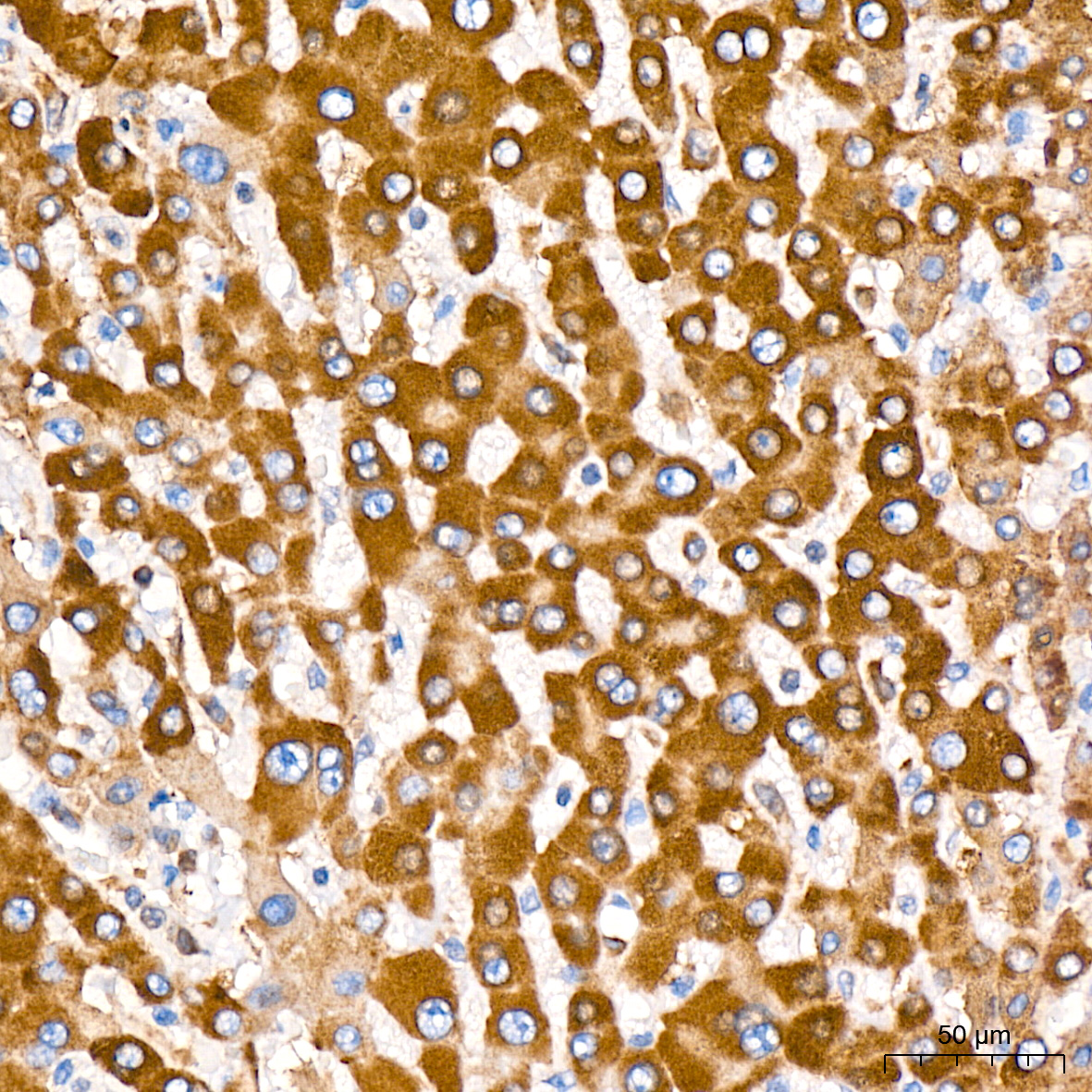 Immunohistochemistry: ERP29 Antibody (1J0D3) [ERP29] - Immunohistochemistry analysis of ERP29 in paraffin-embedded human liver tissue using ERP29 Rabbit mAb  at a dilution of 1:1000 (40x lens). High pressure antigen retrieval was performed with 0.01 M citrate buffer (pH 6.0) prior to IHC staining.