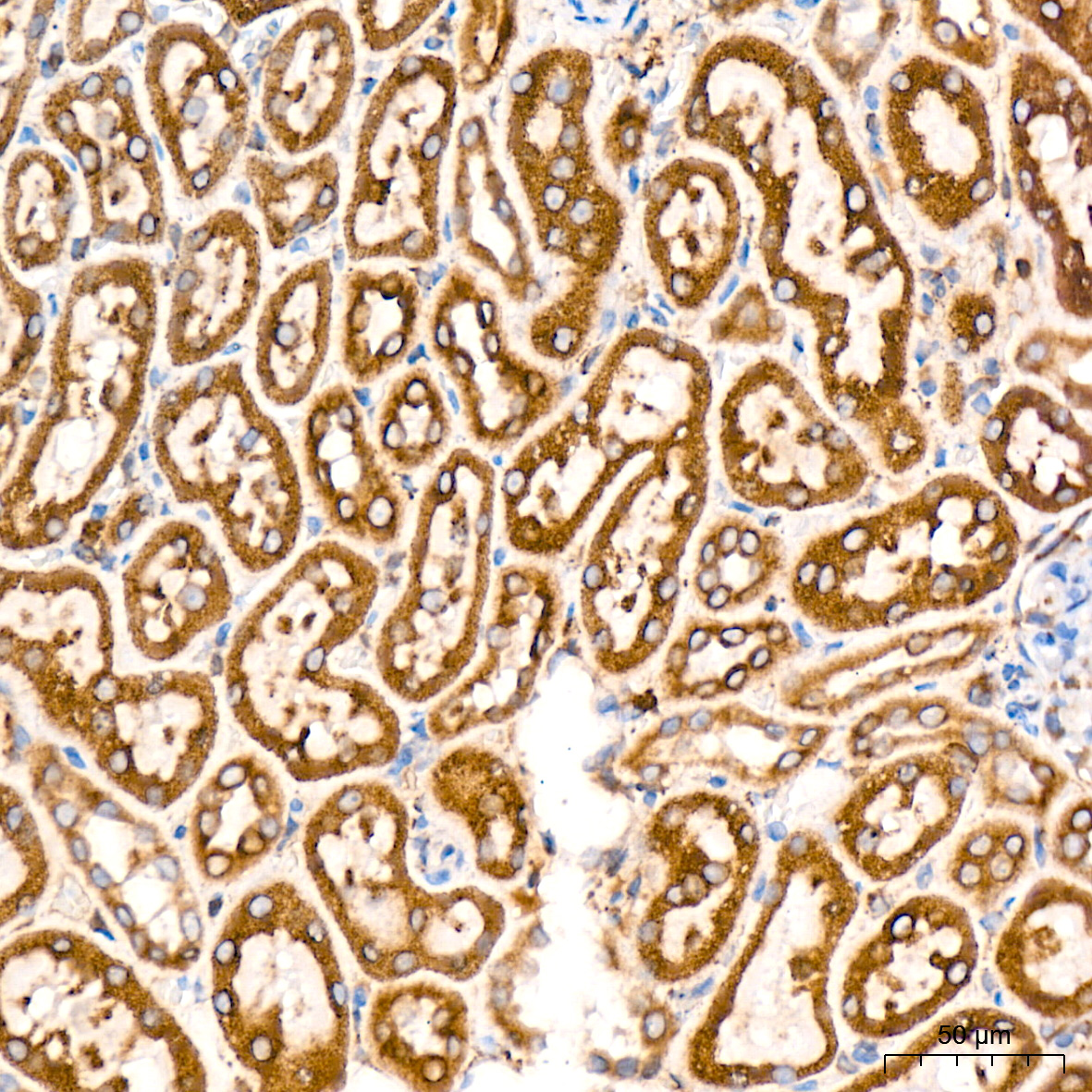 Immunohistochemistry: ERP29 Antibody (1J0D3) [ERP29] - Immunohistochemistry analysis of ERP29 in paraffin-embedded rat kidney tissue using ERP29 Rabbit mAb  at a dilution of 1:1000 (40x lens). High pressure antigen retrieval was performed with 0.01 M citrate buffer (pH 6.0) prior to IHC staining.