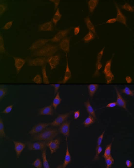 Immunocytochemistry/ Immunofluorescence: Ras Antibody (6J9I4) [Ras] - Immunofluorescence analysis of NIH-3T3 cells using Ras Rabbit mAb  at dilution of 1:100 (40x lens). Secondary antibody: Cy3-conjugated Goat anti-Rabbit IgG (H+L)  at 1:500 dilution. Blue: DAPI for nuclear staining.