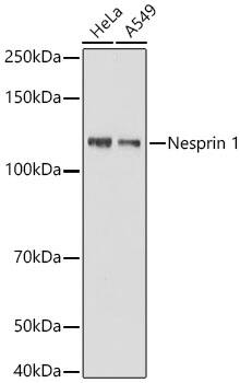 Western Blot: SYNE1 Antibody (1D4D9) [NBP3-15911] - Western blot analysis of various lysates using SYNE1 Rabbit mAb  at 1:1000 dilution. Secondary antibody: HRP Goat Anti-Rabbit IgG (H+L)  at 1:10000 dilution. Lysates / proteins: 25 ug per lane. Blocking buffer: 3 % nonfat dry milk in TBST. Detection: ECL Basic Kit . Exposure time: 10s.