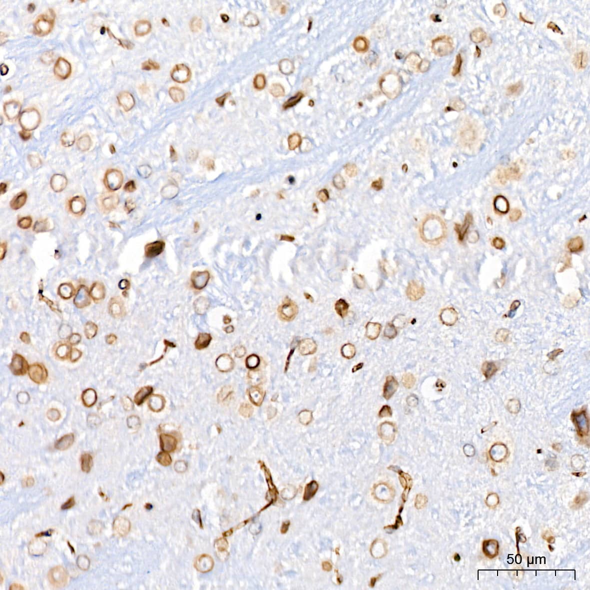 Immunohistochemistry: UNC84B Antibody (8E8D7) [NBP3-15912] - Immunohistochemistry analysis of UNC84B in paraffin-embedded mouse brain tissue using UNC84B Rabbit mAb  at a dilution of 1:200 (40x lens).High pressure antigen retrieval was performed with 0.01 M citrate buffer (pH 6.0) prior to IHC staining.