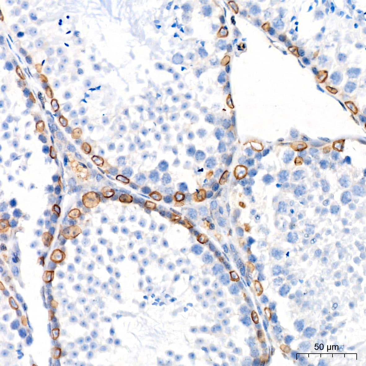 Immunohistochemistry: UNC84B Antibody (8E8D7) [NBP3-15912] - Immunohistochemistry analysis of UNC84B in paraffin-embedded mouse testis tissue using UNC84B Rabbit mAb  at a dilution of 1:200 (40x lens).High pressure antigen retrieval was performed with 0.01 M citrate buffer (pH 6.0) prior to IHC staining.