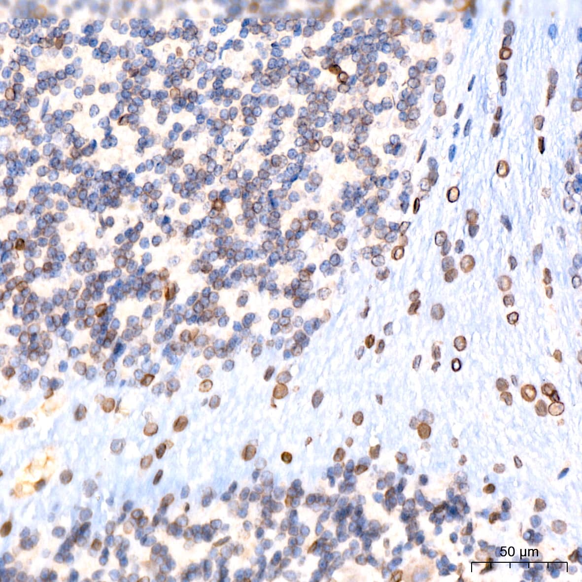 Immunohistochemistry: UNC84B Antibody (8E8D7) [NBP3-15912] - Immunohistochemistry analysis of UNC84B in paraffin-embedded rat brain tissue using UNC84B Rabbit mAb  at a dilution of 1:200 (40x lens).High pressure antigen retrieval was performed with 0.01 M citrate buffer (pH 6.0) prior to IHC staining.