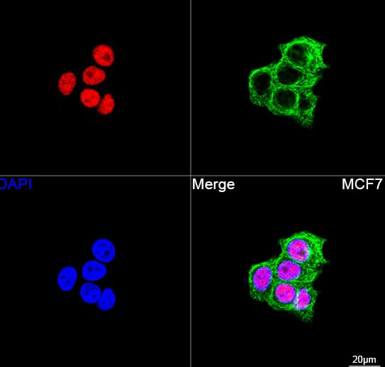 Confocal imaging of MCF7 cells using ZBTB7A/FBI-1/LRF Rabbit mAb (dilution 1:200) followed by a further incubation with Cy3 Goat Anti-Rabbit IgG (H+L) (dilution 1:500) (Red). The cells were counterstained with  alpha -Tubulin Mouse mAb (dilution 1:400) followed by incubation with ABflo® 488-conjugated Goat Anti-Mouse IgG (H+L) Ab (dilution 1:500) (Green). DAPI was used for nuclear staining (Blue). Objective: 100x.