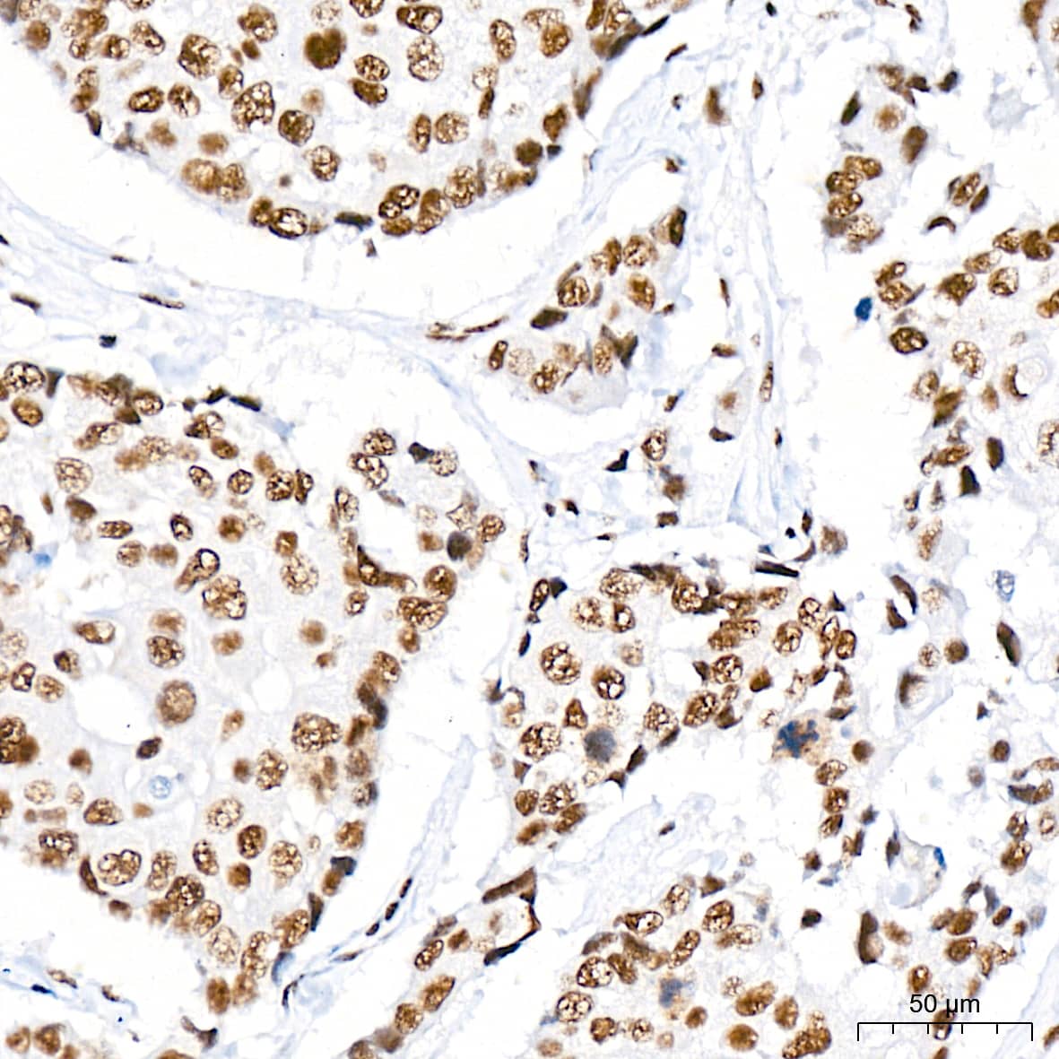 Immunohistochemistry CDC40 Antibody (2I8I7)