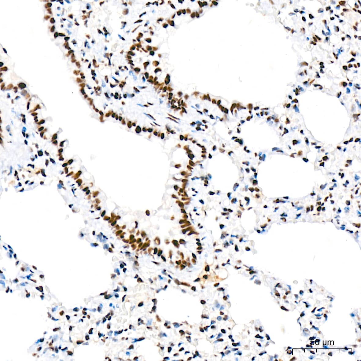 Immunohistochemistry: CDC40 Antibody (2I8I7) [NBP3-15920] - Immunohistochemistry analysis of CDC40 in paraffin-embedded rat lung tissue using CDC40 Rabbit mAb  at a dilution of 1:200 (40x lens). High pressure antigen retrieval was performed with 0.01 M citrate buffer (pH 6.0) prior to IHC staining.