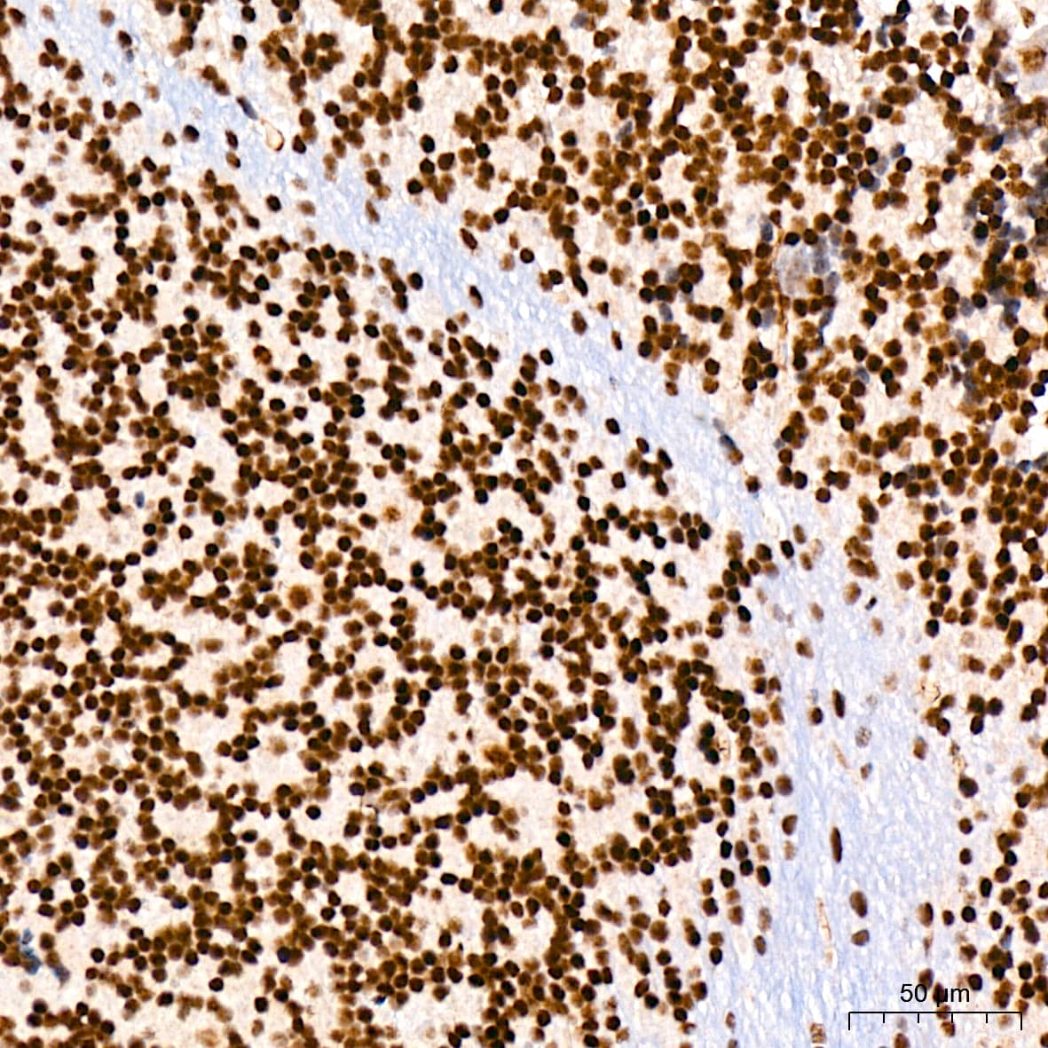 Immunohistochemistry: CDC40 Antibody (2I8I7) [NBP3-15920] - Immunohistochemistry analysis of CDC40 in paraffin-embedded mouse brain tissue using CDC40 Rabbit mAb  at a dilution of 1:200 (40x lens). High pressure antigen retrieval was performed with 0.01 M citrate buffer (pH 6.0) prior to IHC staining.