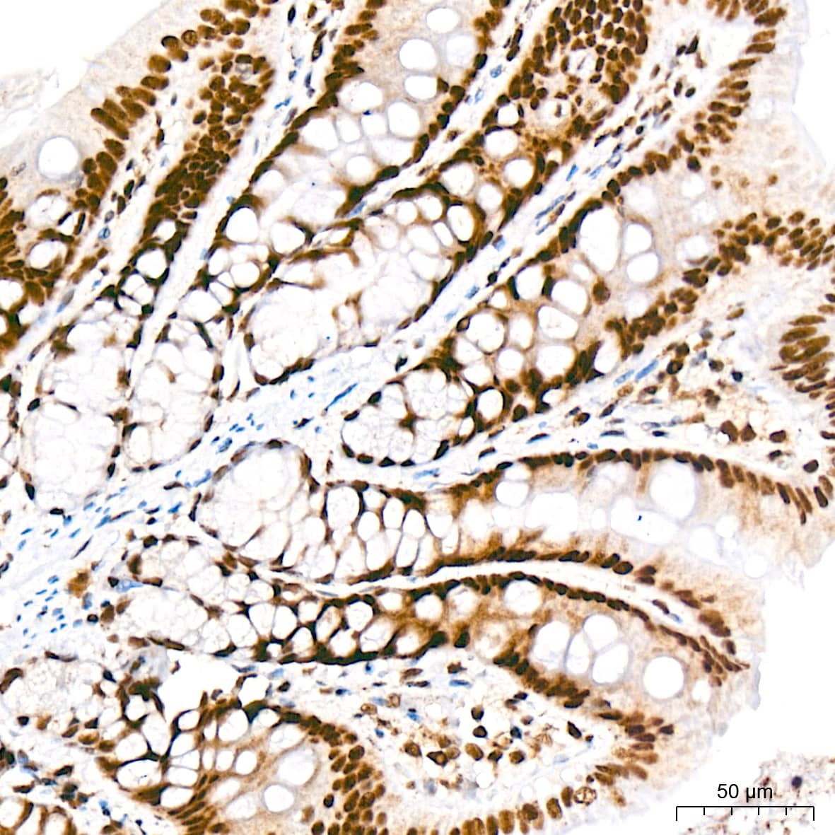 Immunohistochemistry: CDC40 Antibody (2I8I7) [NBP3-15920] - Immunohistochemistry analysis of CDC40 in paraffin-embedded rat colon tissue using CDC40 Rabbit mAb  at a dilution of 1:200 (40x lens). High pressure antigen retrieval was performed with 0.01 M citrate buffer (pH 6.0) prior to IHC staining.