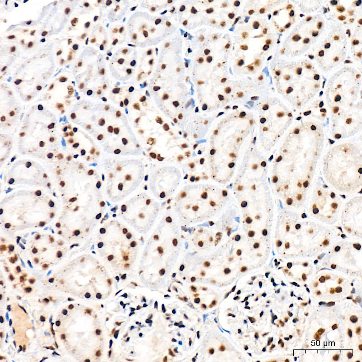 Immunohistochemistry: CDC40 Antibody (2I8I7) [NBP3-15920] - Immunohistochemistry analysis of CDC40 in paraffin-embedded rat kidney tissue using CDC40 Rabbit mAb  at a dilution of 1:200 (40x lens). High pressure antigen retrieval was performed with 0.01 M citrate buffer (pH 6.0) prior to IHC staining.