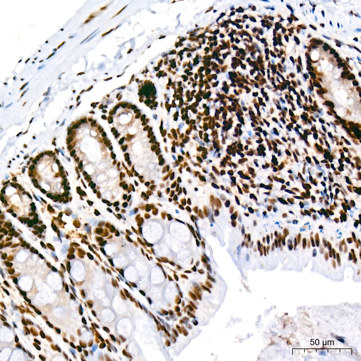 Immunohistochemistry: CDC40 Antibody (2I8I7) [NBP3-15920] - Immunohistochemistry analysis of CDC40 in paraffin-embedded mouse colon tissue using CDC40 Rabbit mAb  at a dilution of 1:200 (40x lens). High pressure antigen retrieval was performed with 0.01 M citrate buffer (pH 6.0) prior to IHC staining.