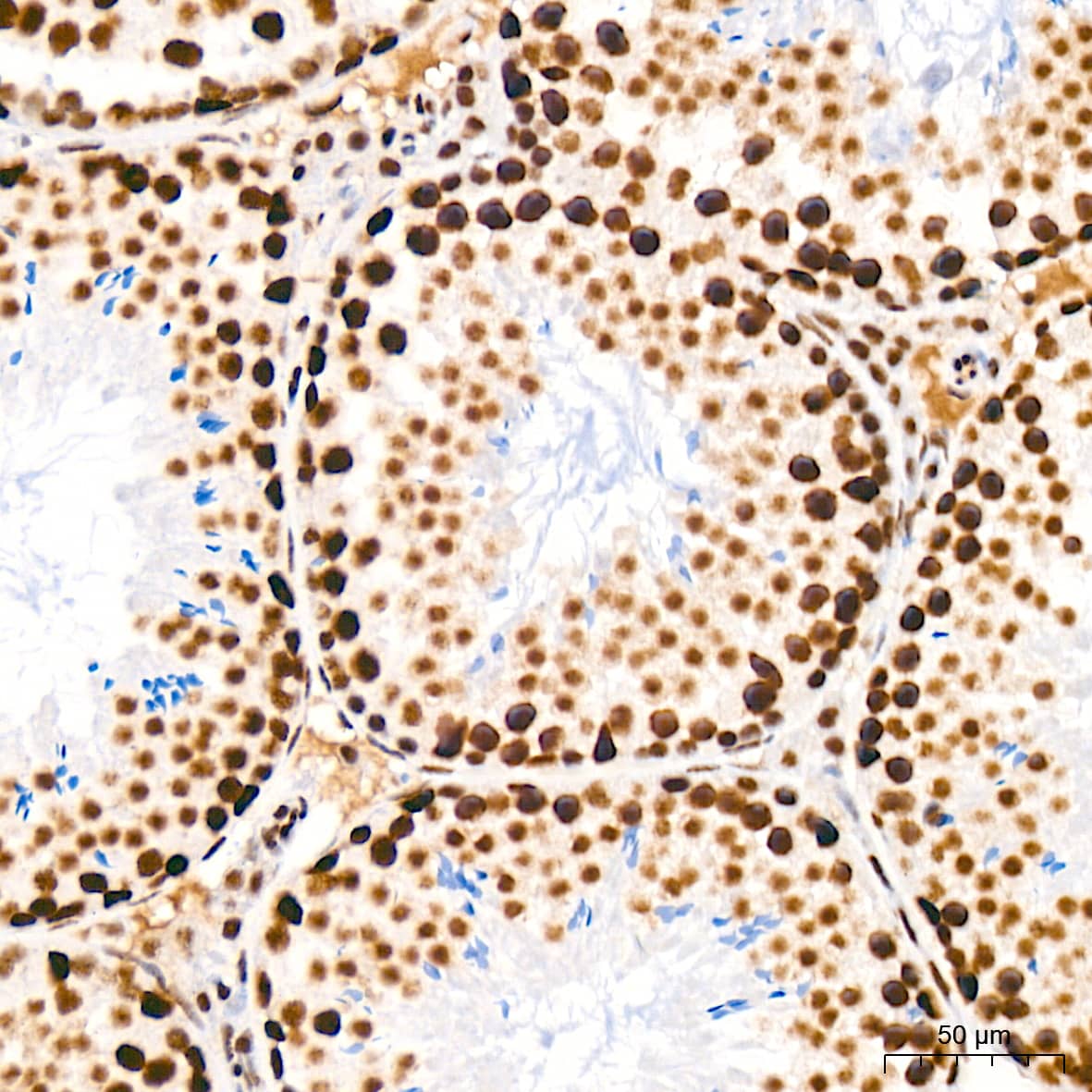 Immunohistochemistry: CDC40 Antibody (2I8I7) [NBP3-15920] - Immunohistochemistry analysis of CDC40 in paraffin-embedded mouse testis tissue using CDC40 Rabbit mAb  at a dilution of 1:200 (40x lens). High pressure antigen retrieval was performed with 0.01 M citrate buffer (pH 6.0) prior to IHC staining.