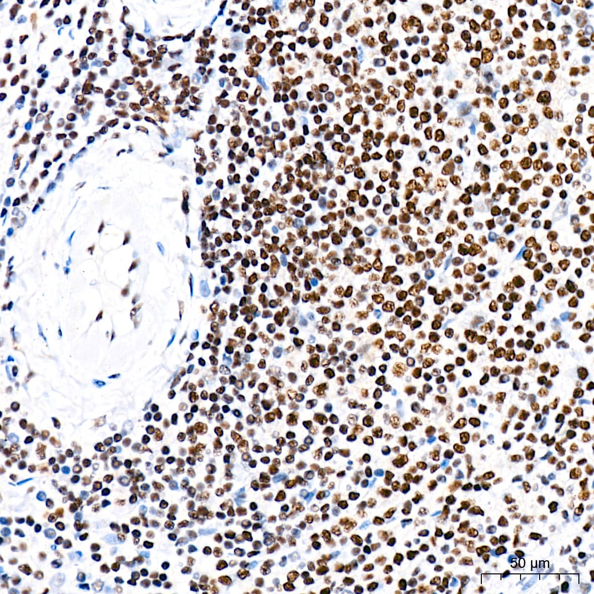 Immunohistochemistry: CDC40 Antibody (2I8I7) [NBP3-15920] - Immunohistochemistry analysis of CDC40 in paraffin-embedded human spleen tissue using CDC40 Rabbit mAb  at a dilution of 1:200 (40x lens). High pressure antigen retrieval was performed with 0.01 M citrate buffer (pH 6.0) prior to IHC staining.