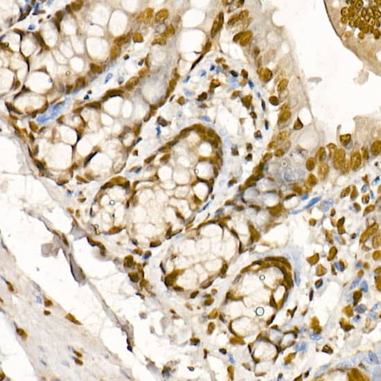 Immunohistochemistry: Histone H3 [Trimethyl Lys36] Antibody (7W5T2) [Histone H3] - Immunohistochemistry analysis of paraffin-embedded Rat colon tissue using Histone H3 Rabbit mAb  at a dilution of 1:500 (40x lens). High pressure antigen retrieval was performed with 0.01 M citrate buffer (pH 6.0) prior to IHC staining.