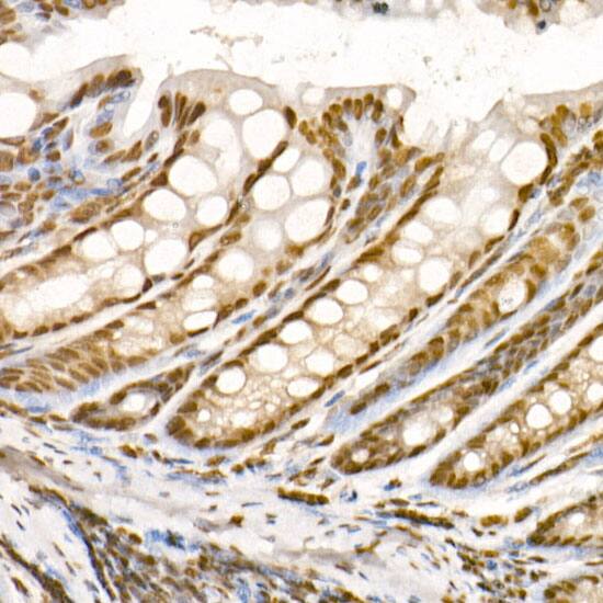 Immunohistochemistry: Histone H3 [Trimethyl Lys36] Antibody (7W5T2) [Histone H3] - Immunohistochemistry analysis of paraffin-embedded Mouse colon tissue using Histone H3 Rabbit mAb  at a dilution of 1:500 (40x lens). High pressure antigen retrieval was performed with 0.01 M citrate buffer (pH 6.0) prior to IHC staining.