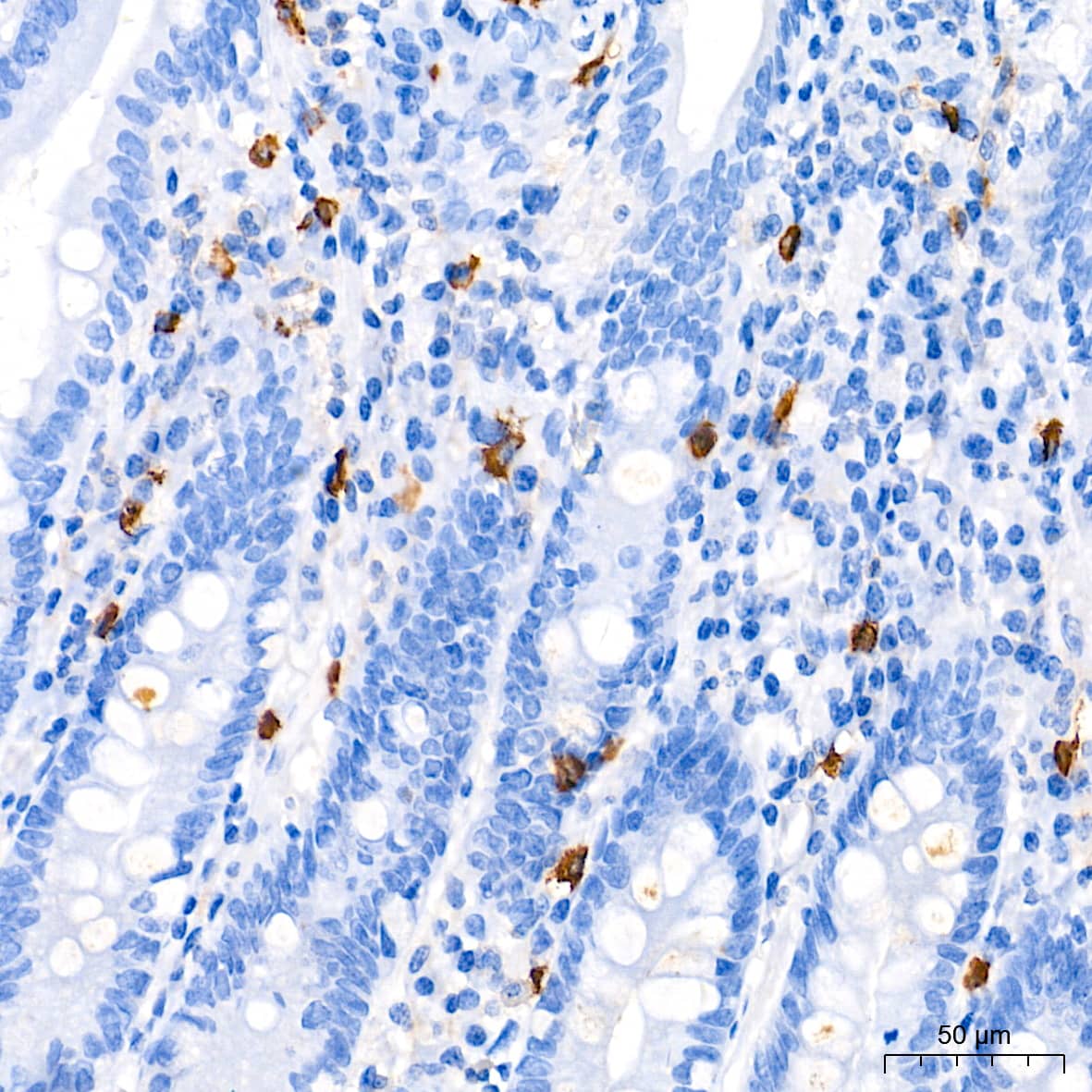 Immunohistochemistry: Tryptase beta-2/TPSB2 Antibody (6U1C5) [Tryptase beta-2/TPSB2] - Immunohistochemistry analysis of paraffin-embedded Human small intestine tissue using Tryptase beta-2/TPSB2 Rabbit mAb  at a dilution of 1:40000 (40x lens). High pressure antigen retrieval performed with 0.01M Tris-EDTA Buffer (pH 9.0) prior to IHC staining.