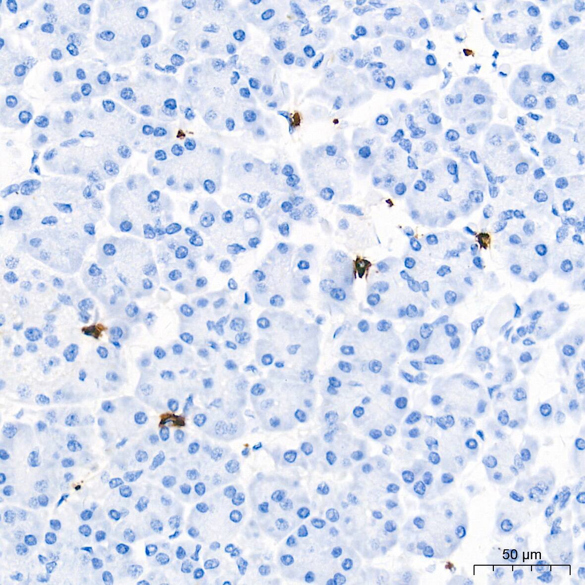 Immunohistochemistry: Tryptase beta-2/TPSB2 Antibody (6U1C5) [NBP3-15925] - Immunohistochemistry analysis of paraffin-embedded Human pancreas tissue using Tryptase beta-2/TPSB2 Rabbit mAb  at a dilution of 1:40000 (40x lens). High pressure antigen retrieval performed with 0.01M Tris-EDTA Buffer (pH 9.0) prior to IHC staining.