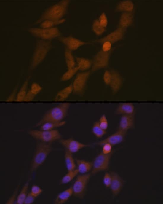 Immunocytochemistry/ Immunofluorescence: STK33 Antibody (1E4W7) [NBP3-15926] - Immunofluorescence analysis of NIH/3T3 cells using STK33 Rabbit mAb  at dilution of 1:100 (40x lens). Blue: DAPI for nuclear staining.